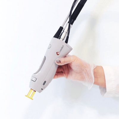 Candela laser hair removal device used at Accesa Health