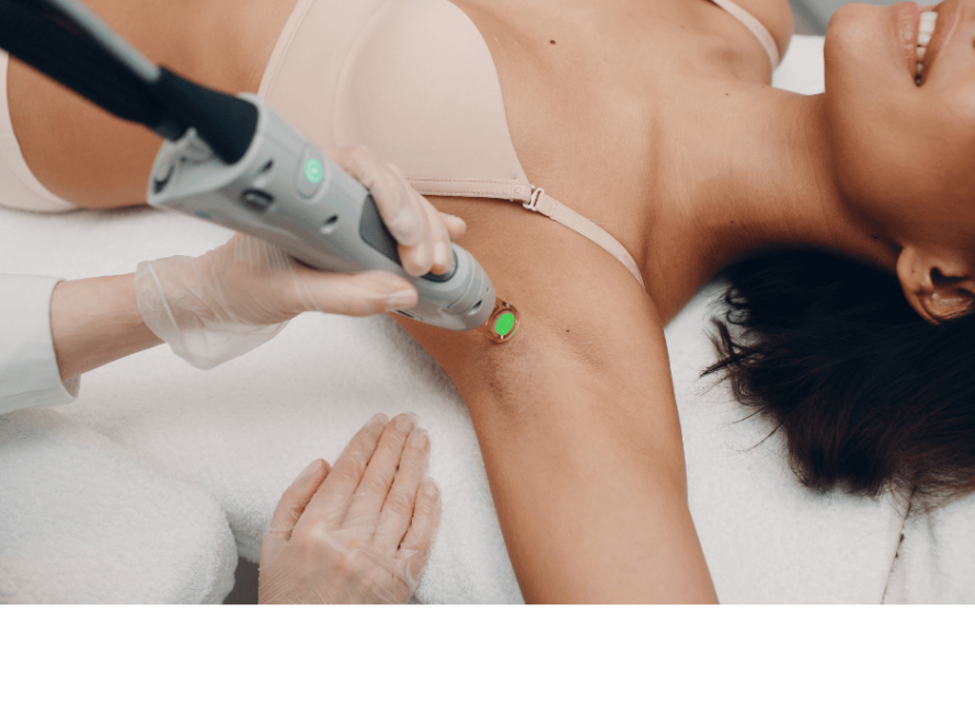 Candela underarm laser hair removal available at Accesa Health